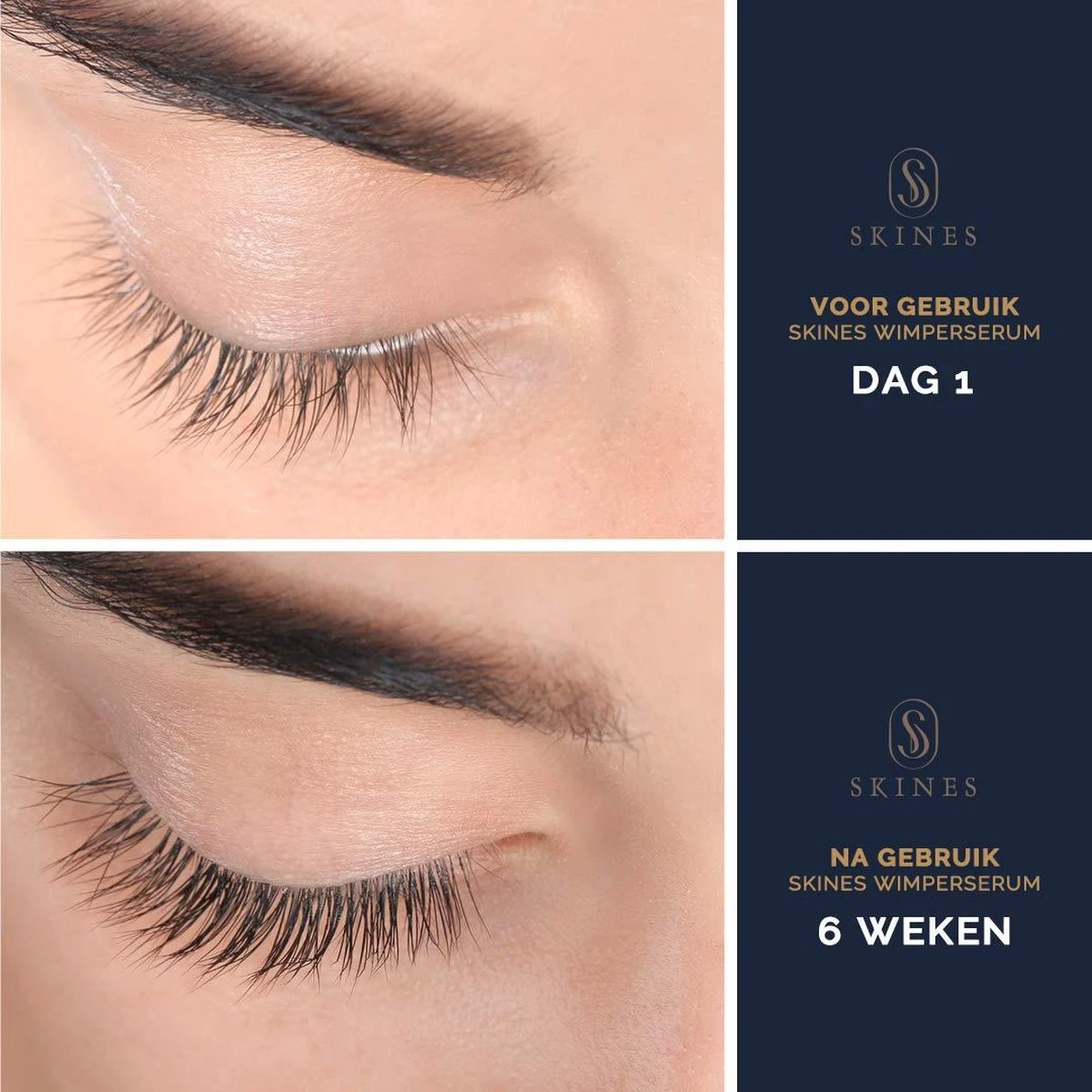 Skines® Wimperserum Premium – Eyelash Serum - Wenkbrauw Serum - Wimper Groei - 3ML 2 Skines® Wimperserum Premium – Eyelash Serum - Wenkbrauw Serum - Wimper Groei - 3ML - Afbeelding 2