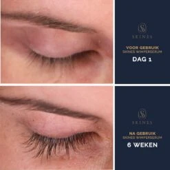 Skines® Wimperserum Premium – Eyelash Serum - Wenkbrauw Serum - Wimper Groei - 3ML 13 Skines® Wimperserum Premium – Eyelash Serum - Wenkbrauw Serum - Wimper Groei - 3ML -Oogmake Up Winkel 1200x1200 309