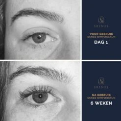 Skines® Wimperserum Premium – Eyelash Serum - Wenkbrauw Serum - Wimper Groei - 3ML 14 Skines® Wimperserum Premium – Eyelash Serum - Wenkbrauw Serum - Wimper Groei - 3ML -Oogmake Up Winkel 1200x1200 310