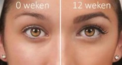 100% Natuurlijke Groei - Wenkbrauwserum - Vollere Wenkbrauwen - Castor Olie - Wenkbrauw Serum - 10ML -Oogmake Up Winkel 1200x645