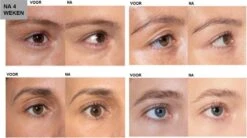 L'Oréal Paris Clinically Proven Wimperserum - 2 Ml -Oogmake Up Winkel 1200x670