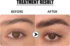 Flora Ruby - Wimper & Wenkbrauw Lifting Set 2 In 1 - Professionele 2 In 1 Lash Lift & Brow Lamination Kit - Permanente Wimperkruller 12 Flora Ruby - Wimper & Wenkbrauw Lifting Set 2 In 1 - Professionele 2 In 1 Lash Lift & Brow Lamination Kit - Permanente Wimperkruller -Oogmake Up Winkel 1200x782