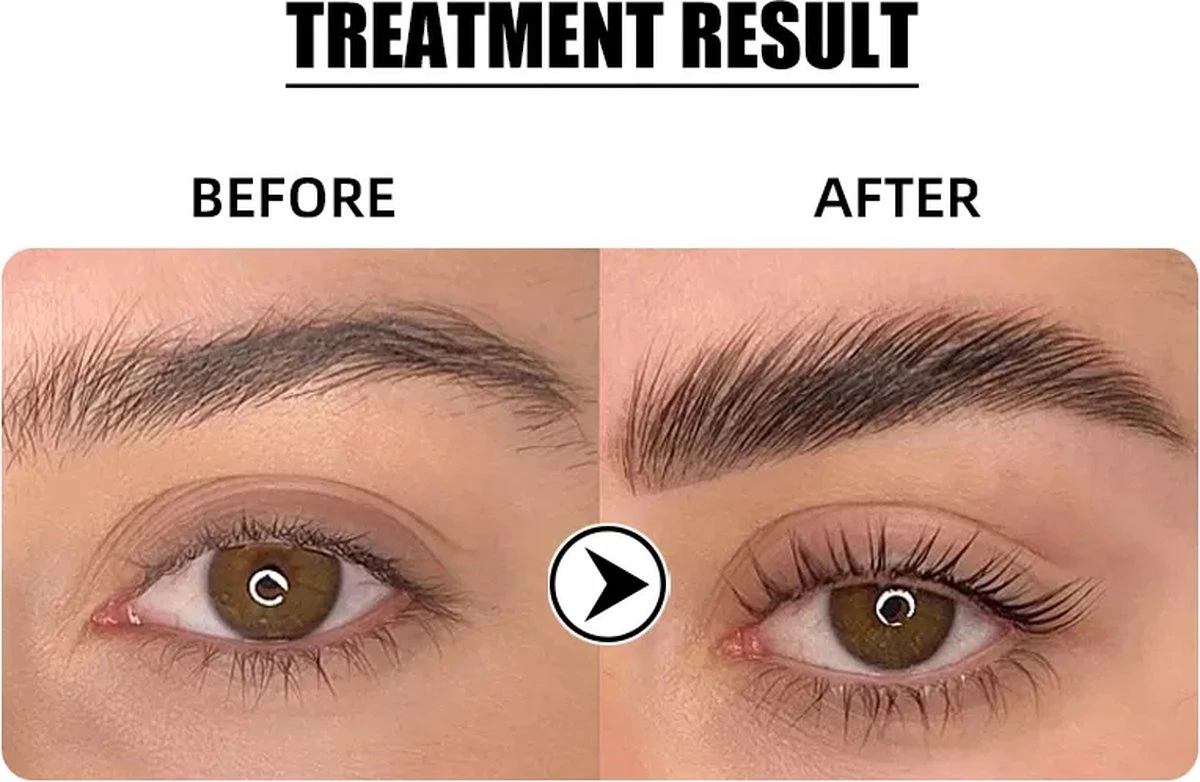 Flora Ruby - Wimper & Wenkbrauw Lifting Set 2 In 1 - Professionele 2 In 1 Lash Lift & Brow Lamination Kit - Permanente Wimperkruller 4 Flora Ruby - Wimper & Wenkbrauw Lifting Set 2 In 1 - Professionele 2 In 1 Lash Lift & Brow Lamination Kit - Permanente Wimperkruller - Afbeelding 4