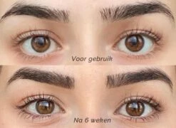 Skines® Wimperserum Premium – Eyelash Serum - Wenkbrauw Serum - Wimper Groei - 3ML 16 Skines® Wimperserum Premium – Eyelash Serum - Wenkbrauw Serum - Wimper Groei - 3ML -Oogmake Up Winkel 1200x874