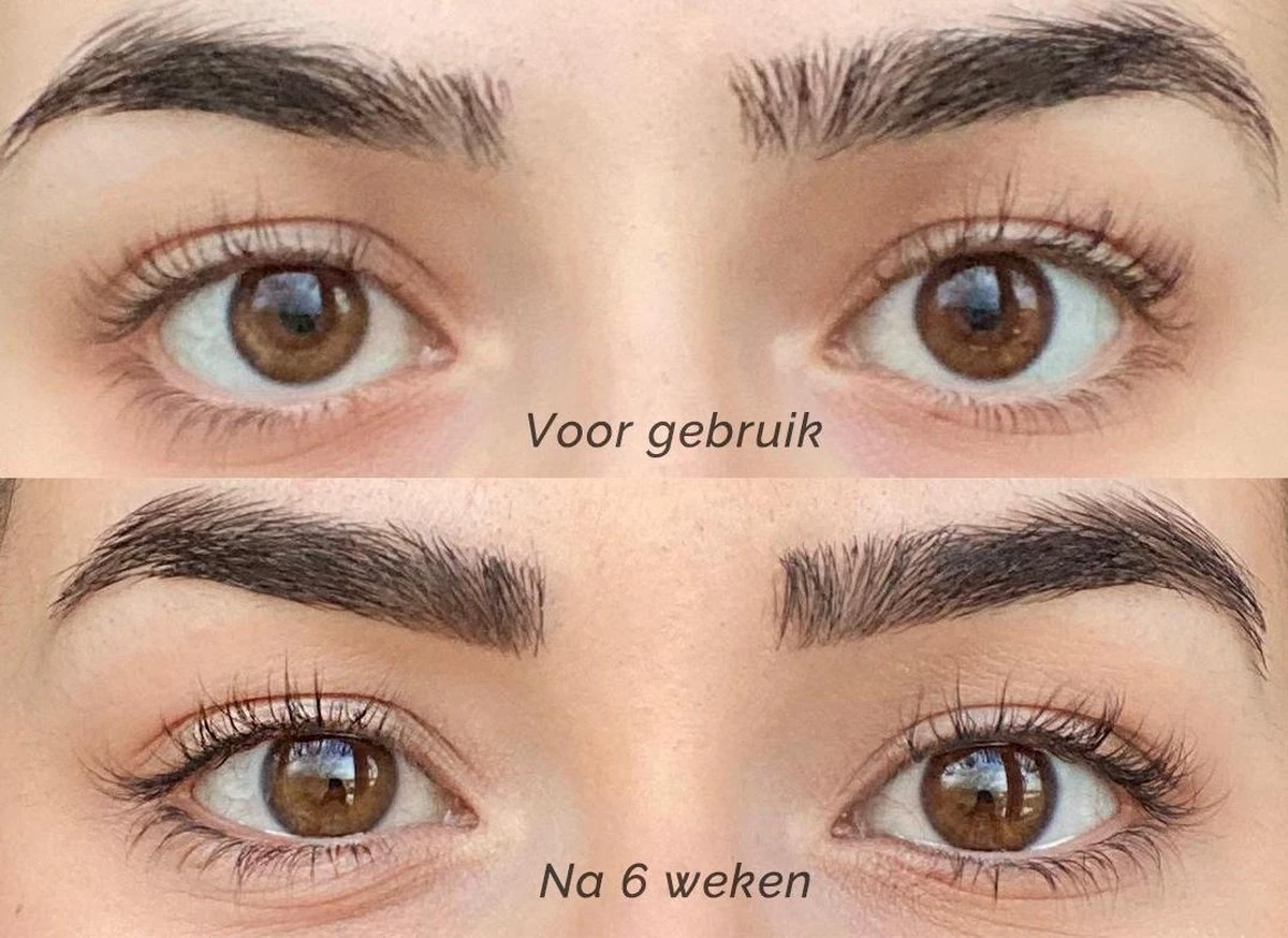 Skines® Wimperserum Premium – Eyelash Serum - Wenkbrauw Serum - Wimper Groei - 3ML 8 Skines® Wimperserum Premium – Eyelash Serum - Wenkbrauw Serum - Wimper Groei - 3ML - Afbeelding 8
