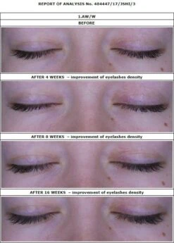 Oceanic Long4Lashes Gold Eyelash Wimpernserum 4 Ml -Oogmake Up Winkel 859x1200